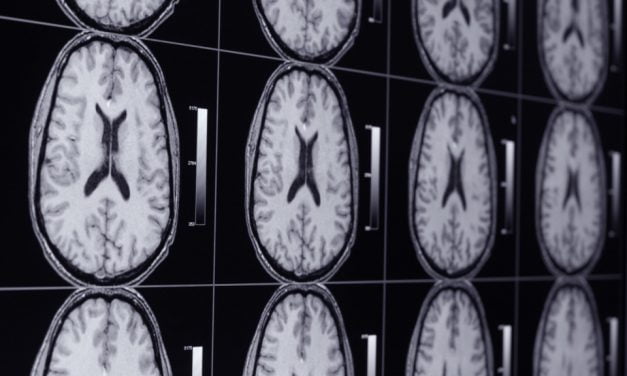 ¿Cómo olvida el cerebro un recuerdo desagradable?
