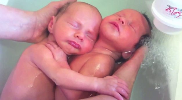 Dos gemelos que aún no saben que han nacido