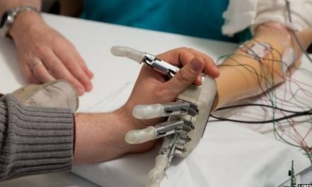 Científicos crean prótesis robótica con sentido al tacto