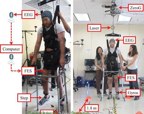 Un hombre vuelve a caminar de nuevo tras cinco años de parálisis