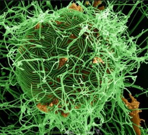Partículas del virus Ébola (verde) alrededor de una célula infectada crónicamente. Fotografía de NIAID.