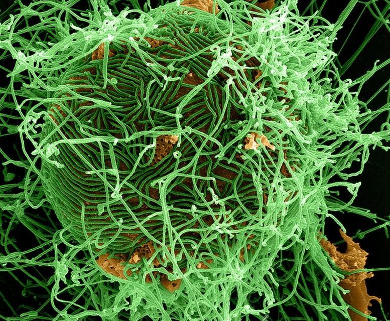 Adiós Ébola adiós