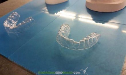 Ortodoncia DIY con impresora 3D