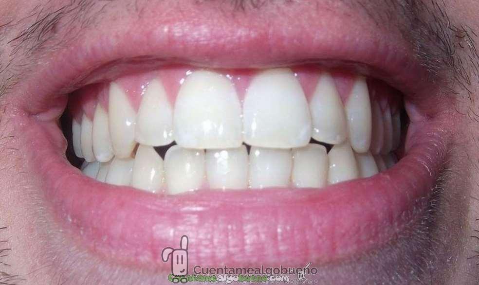 Nueva pasta de dientes reparadora