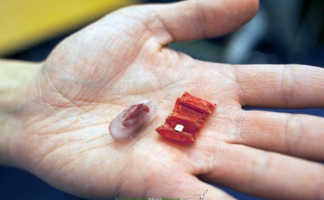 Mini-robot que extrae pilas ingeridas