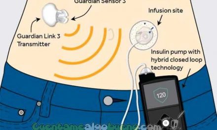 Crean una bomba de insulina semiautomática para los enfermos de diabetes