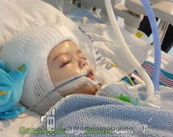 20161017-2-separan-gemelos-siameses-unidos-por-la-cabeza-04