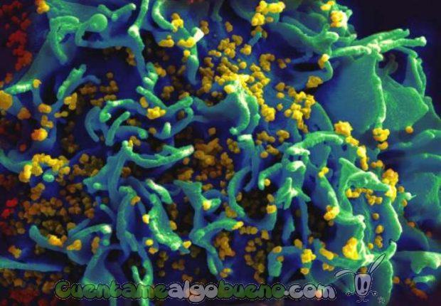 Una célula infectada por el virus VIH. Foto de NIAID.