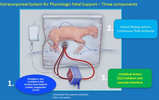 Esquema del sistema para soporte fetal fisiológico. Foto: CHOP.