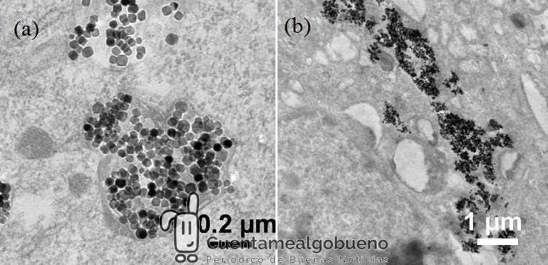 Nanopartículas magnéticas para luchar contra el cáncer