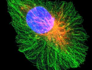 Claraboya. Microtúbulos