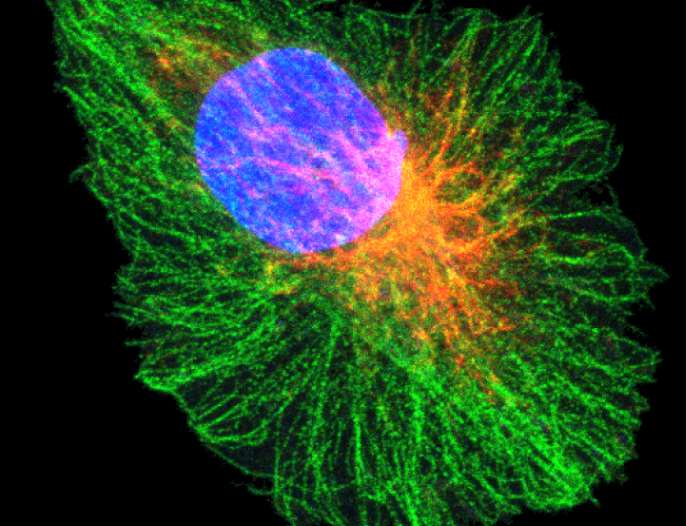 Claraboya. MICROTÚBULOS