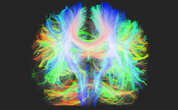Descubren un biomarcador que puede detectar la fase inicial del párkinson