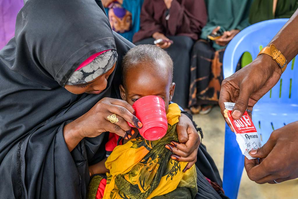 El personal del centro de salud alimenta al desnutrido Muad con el Ready-to-Eat Therapeutic (RUTF) para evaluar su apetito y su capacidad para tragar este suplemento nutricional. Muad, de un año y medio, en brazos de su madre, Fatuma Mohammed Osman, de 25 años, pesa sólo 15 libras (unos 7 kilos), lo que confirma que está gravemente desnutrido.Fotografía del Centro de Salud Materno Infantil de Darusalam en Baidoa, Somalia, financiado por Global Affairs Canada y administrado por World Vision.