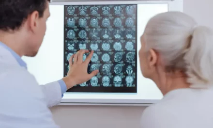 Descubren una nueva diana para frenar la metástasis cerebral