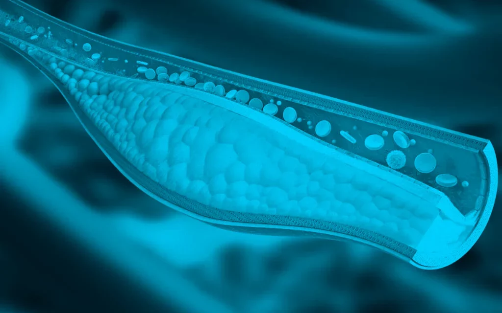 Aitheroscope, el proyecto español finalista en los Premios a la Innovación Social de Fundación Mapfre